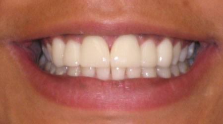 smile-gallery gallery